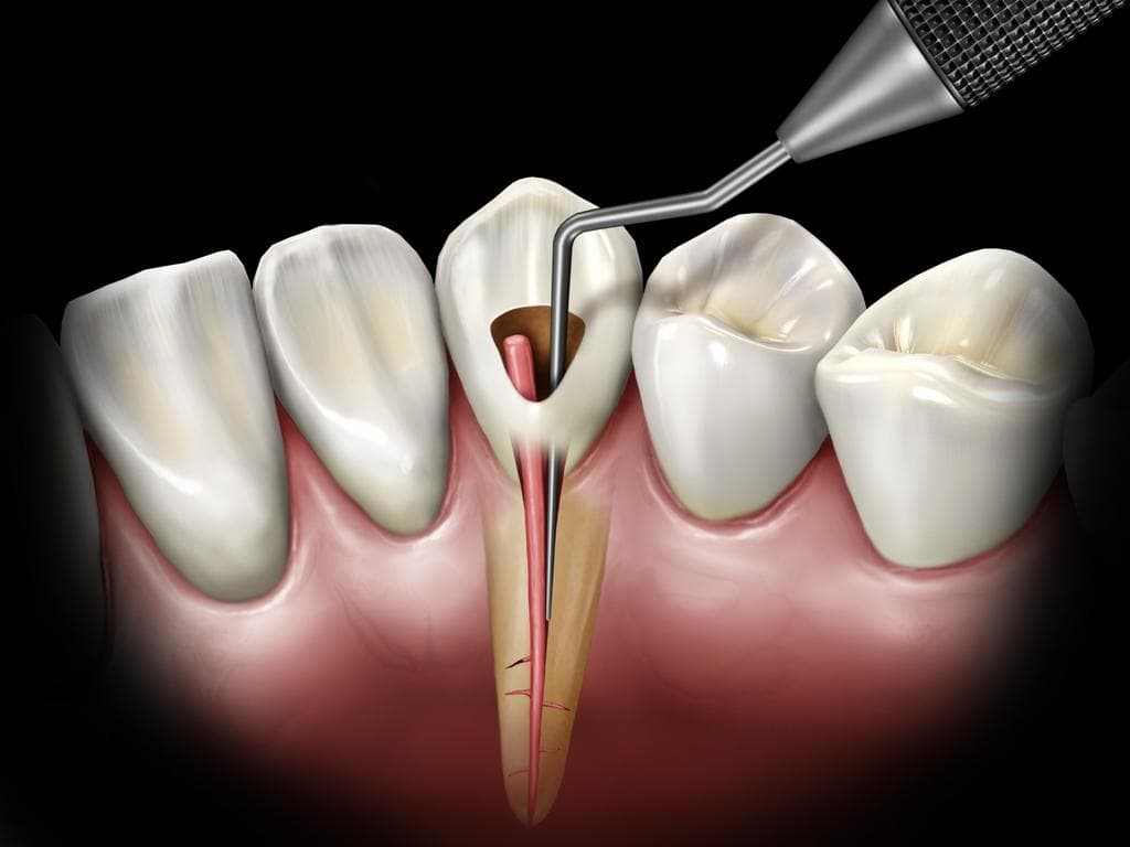 Endodonti